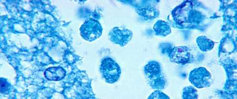 Brain-eating amoeba, Naegleria fowleri