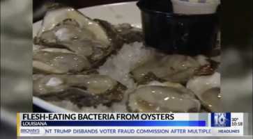 Vibrio, flesh-eating bacteria, contracted from raw oysters